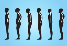 Cause della postura errata