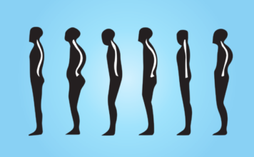 Cause della postura errata