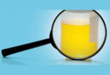 Cosa vuol dire quando la pipì puzza urine maleodoranti pipì che puzza