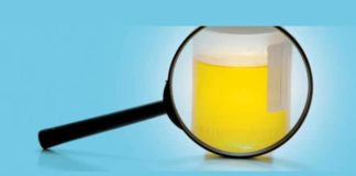 Cosa vuol dire quando la pipì puzza urine maleodoranti pipì che puzza