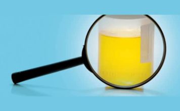 Cosa vuol dire quando la pipì puzza urine maleodoranti pipì che puzza